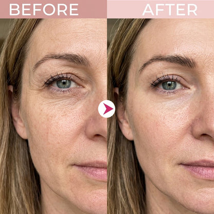 💖Trusted-by-over-50-000-women💖 Eye Renewal Crème
