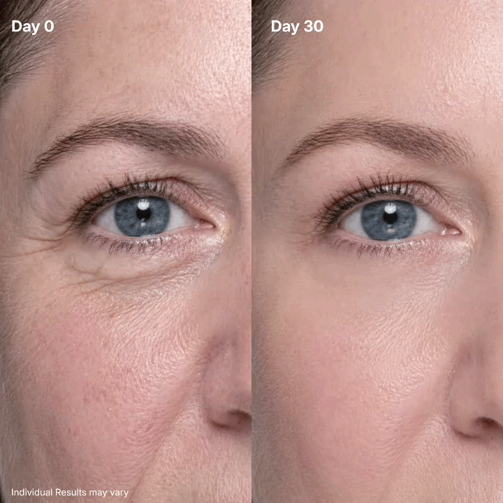 💖Trusted-by-over-50-000-women💖 Eye Renewal Crème